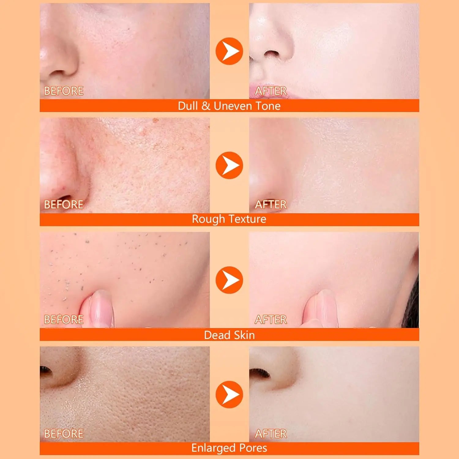 Kojic acid turmeric body spray application on elbows showing skin brightening effects
