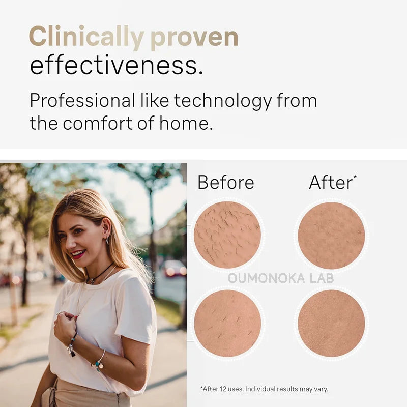 Close-up of IPL hair removal device with -10°C freezing technology cooling head
